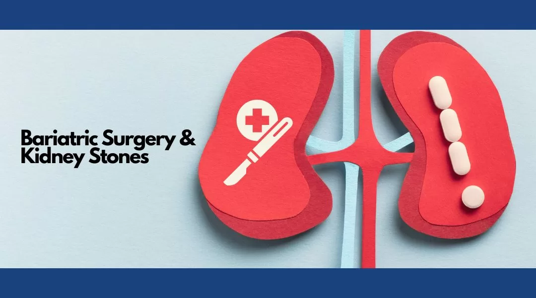 Bariatric Surgery and Kidney Stones formation - Dr Ravi Rao, Perth, Australia